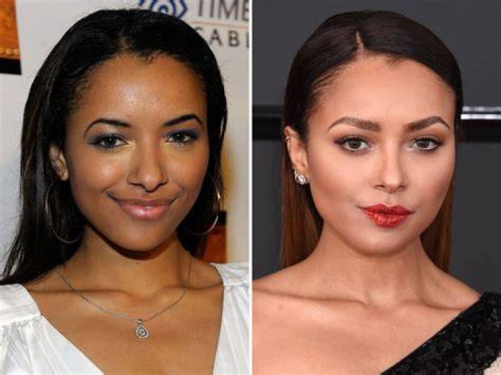 Kat Graham Before and After The Skincare Edit
