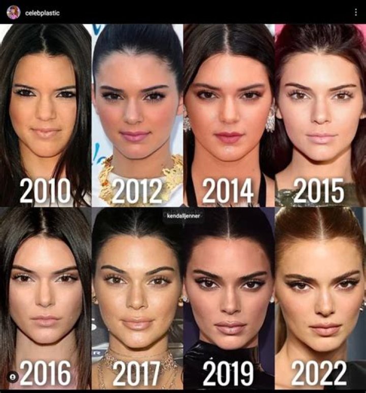 Kendall Jenner's Weight Journey And Body Image Truths