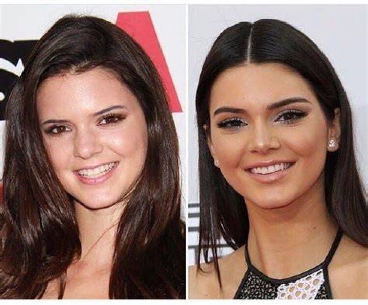 Kendall Jenner Weight Loss Tweet Weight loss