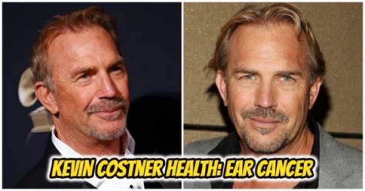 Kevin Costner Ear Cancer Surgery Update What Happened?