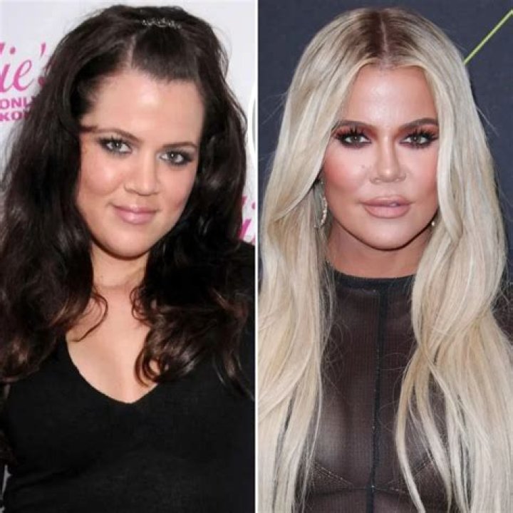 Khloe Kardashian Plastic Surgery Did She Get A Nose Job? Celeb Dirty