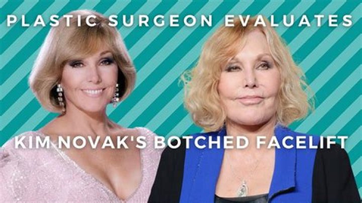 Kim Novak reveals plastic surgery regrets in new interview