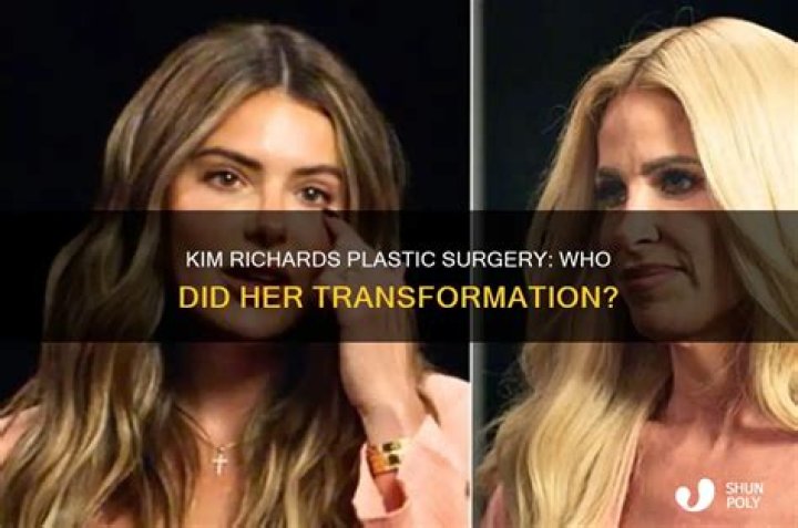 Kim Richards plastic surgery (13) Celebrity plastic surgery online