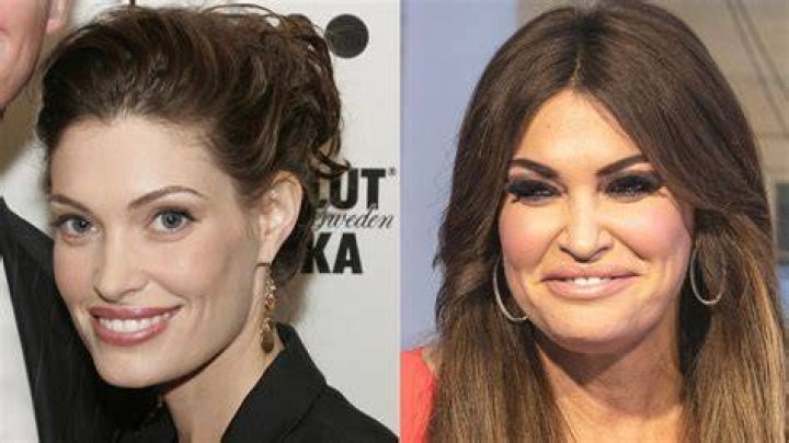 Kimberly Guilfoyle's Plastic Surgery Journey: Unveiling The Truth