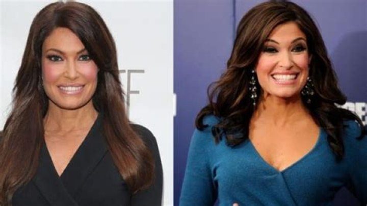 Kimberly Guilfoyle Plastic Surgery Facelift, breast augmentation