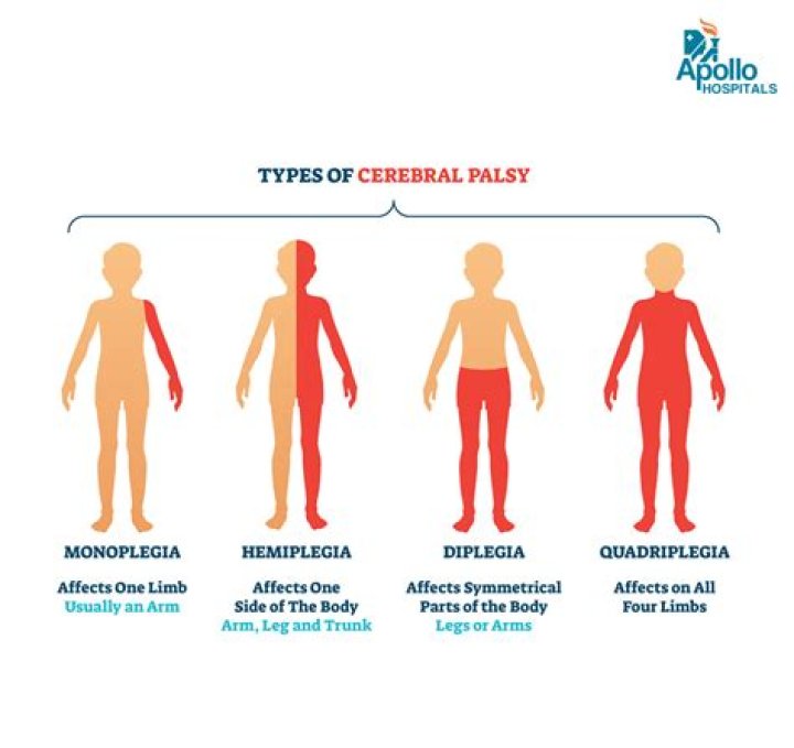 Kristen Schaal Bell&rsquo;s Palsy Diagnosis And Experience