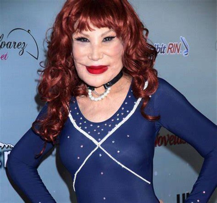 La vedette Lyn May es fuertemente criticada por como luce su rostro y