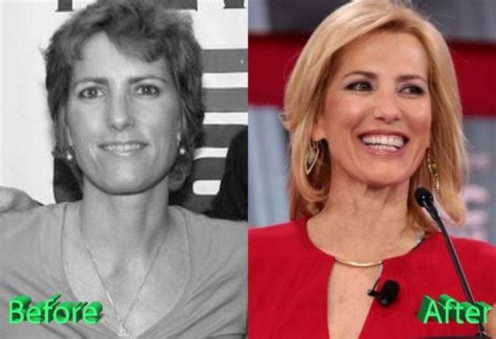 Laura Ingraham Before and After Plastic Surgery Celebrity plastic