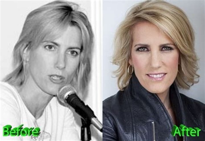 Laura Ingraham Plastic Surgery Nothing More Than A Gossip? Celebrity