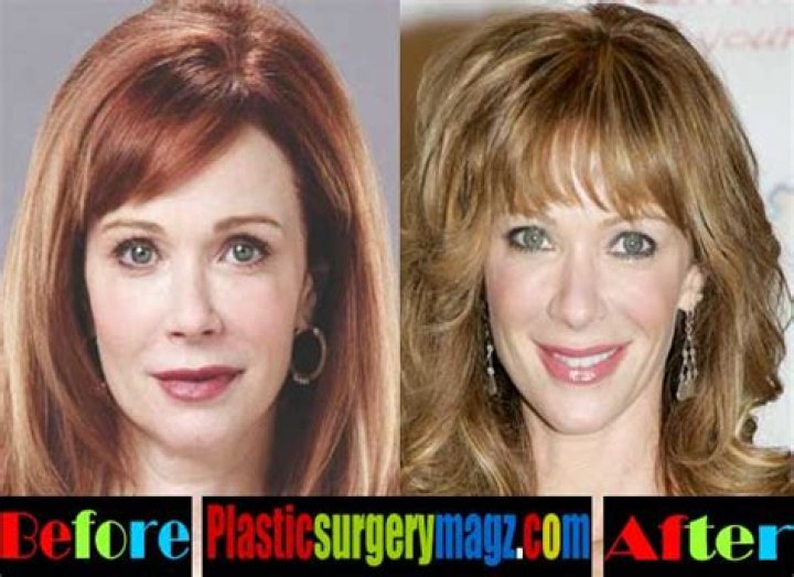 Lauren Holly plastic surgery here and there Plastic surgery