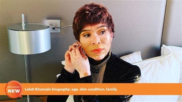 Leleti Khumalo bio age, skin condition, twins, husband, and more