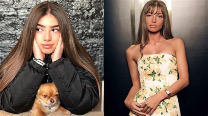 Life Of Mimi Keene Before Surgery