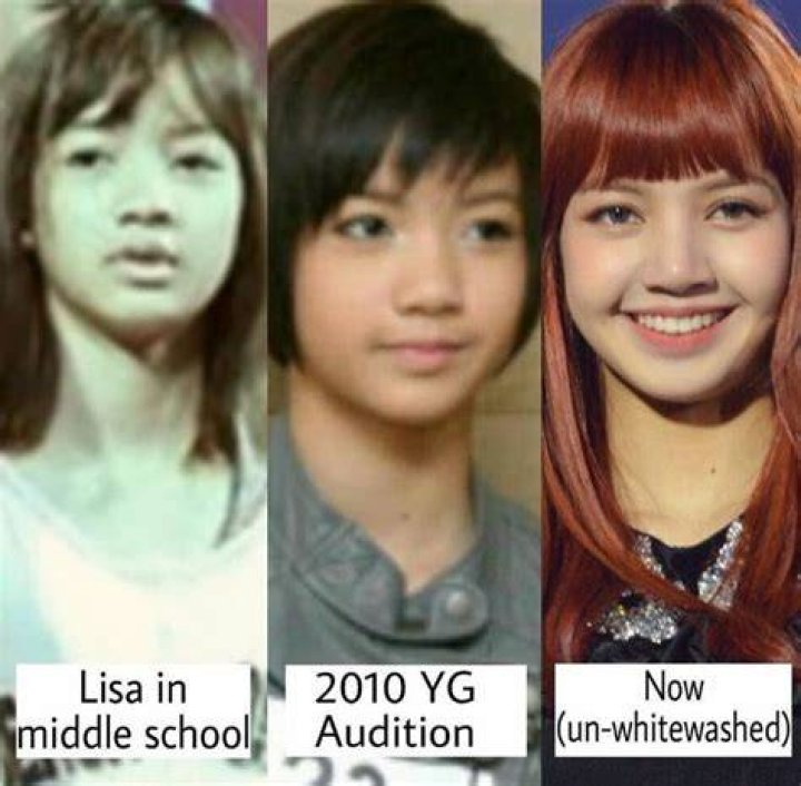 Lisa before BLACKPINK these are her surgeries. en 2023 Cantantes