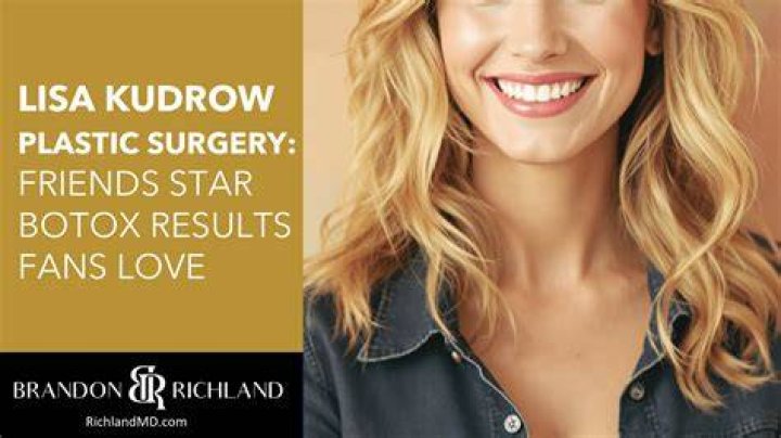 Lisa Helou&rsquo;s Plastic Surgery Has the Selling the OC Cast Undergone