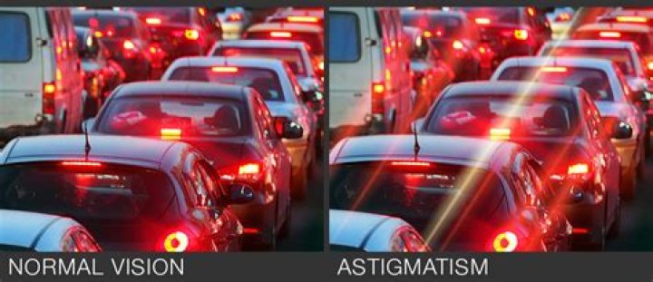 Living With Astigmatism (2022)