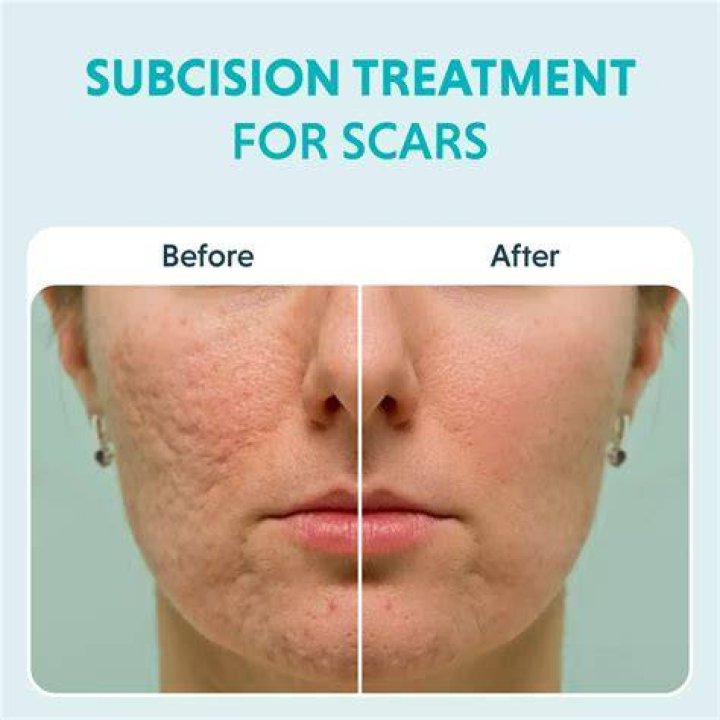Living with facial scars in Nigeria