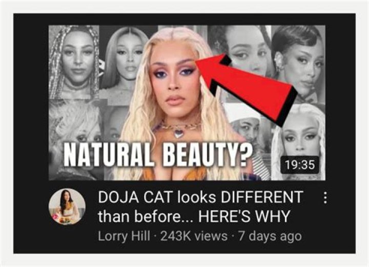 Lorry Hill Doja Cat Plastic Surgery Analysis (REUPLOADED) YouTube