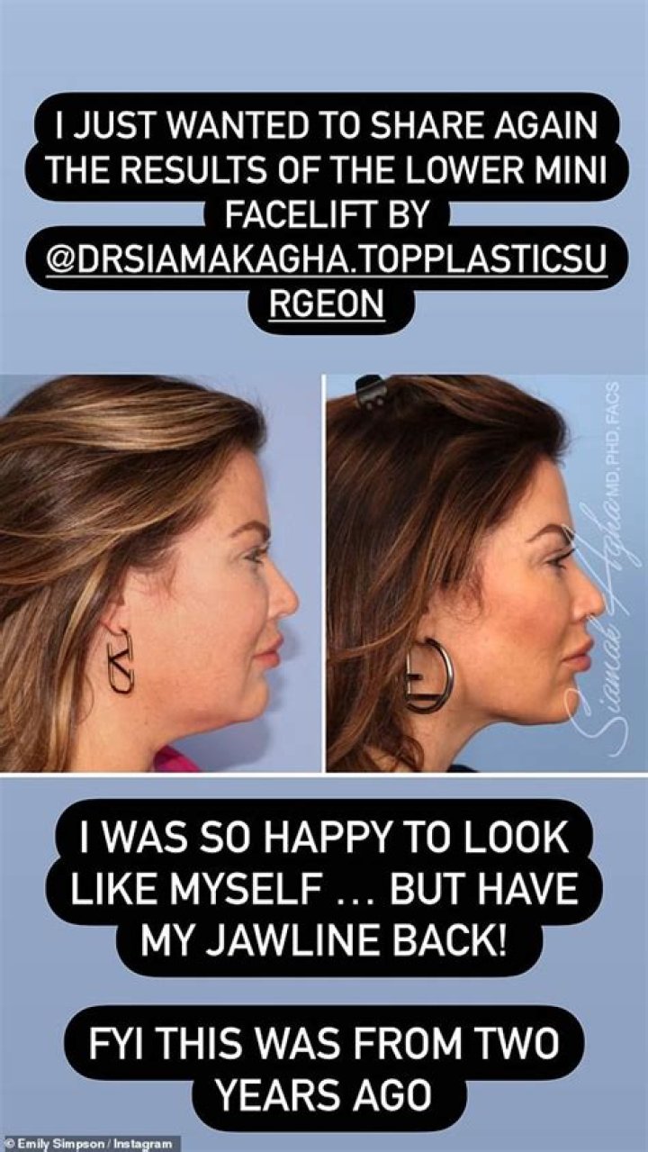 &lsquo;RHOC&rsquo; Star Emily Simpson&rsquo;s Plastic Surgeon Tells All