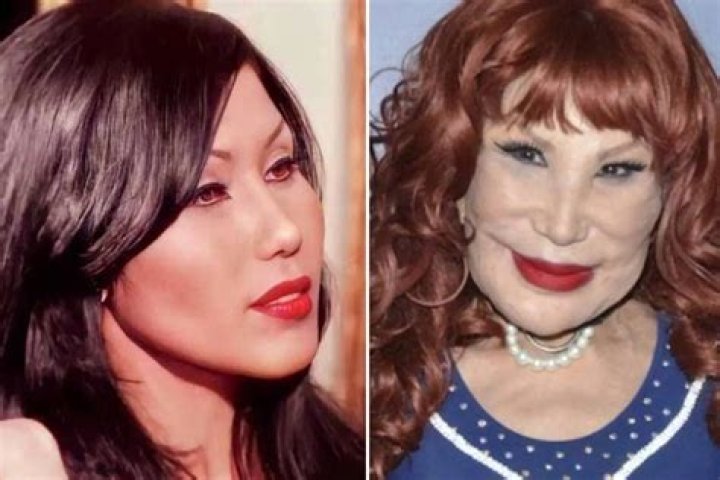 Lyn May Plastic Surgery Destroyed Her Face What Happened to Lyn May
