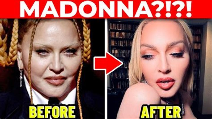 Madonna Has Been AgeShamed Again. Can We Cut the Singer a Break?