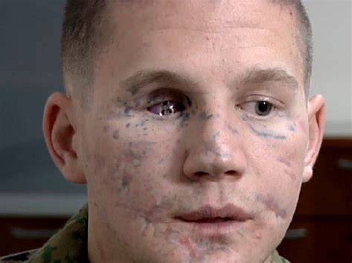 Marcus Luttrell Gunshot Wounds