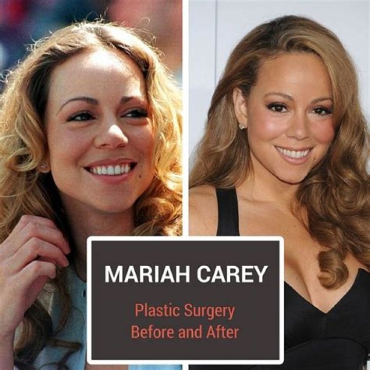 Mariah Carey&rsquo;s Plastic Surgery Before and After Celebrity Surgery