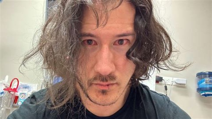 Markiplier shares a shocking selfie from hospital &raquo; TalkEsport