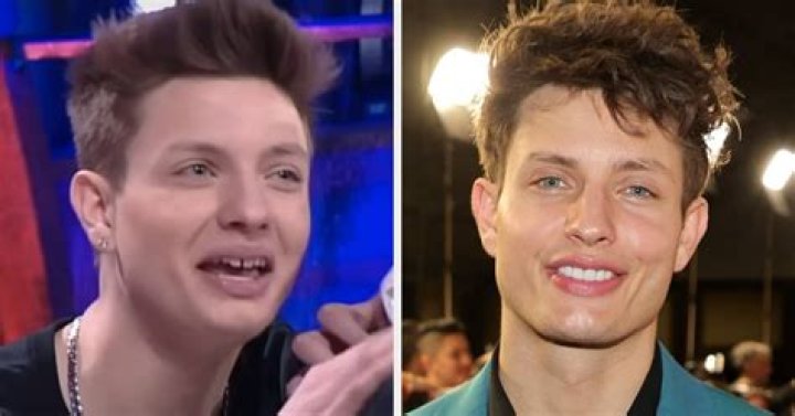 Matt Rife Plastic Surgery