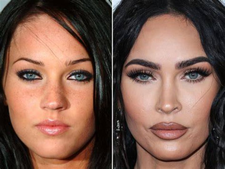 Megan Fox before and after plastic surgery boob job and lifting 2018