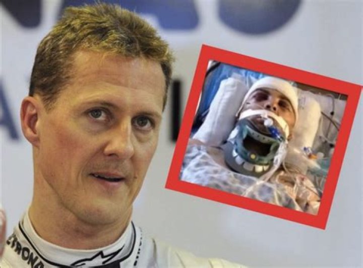 Michael Schumacher Accident How Is He Now? His Legacy