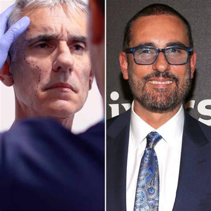 Miguel Varoni los detalles de su rejuvenecimiento facial y corporal