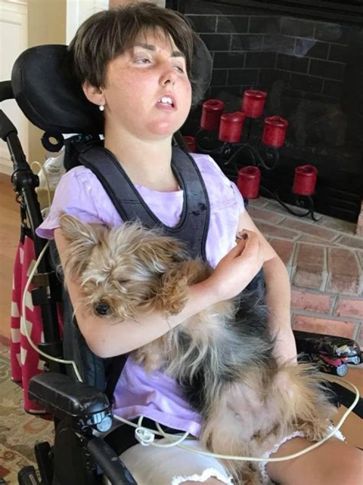 Mikayla Resh, an inspiration for people with disabilities, has died