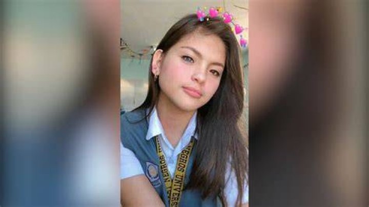 MODELONG SI JULIA GWYNYTH OSTAN NA MAY MAGKAIBANG KULAY NG MATA