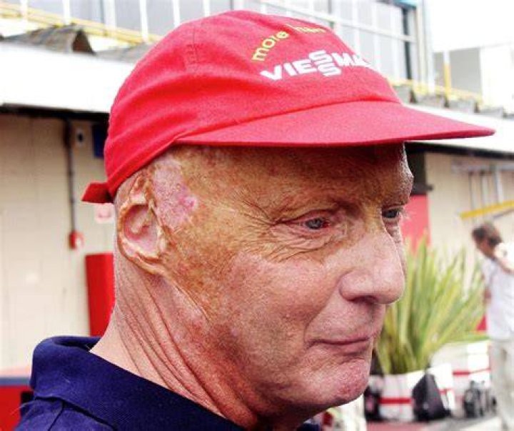 Morre Niki Lauda tricampe&atilde;o mundial da F1, aos 70 anos Revista HG