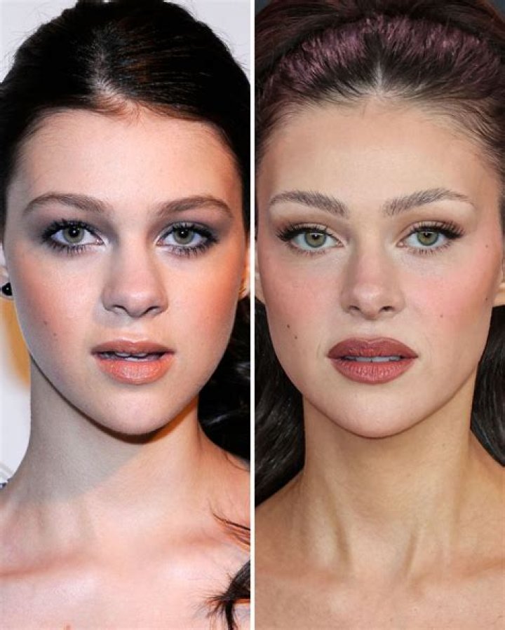 Nicola Peltz, Before and After Nicolas peltz, Bad contouring, Plastic