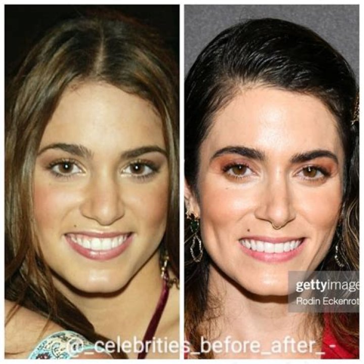 Nikki Reed Plastic Surgery Before And After Photos 2018 Plastic