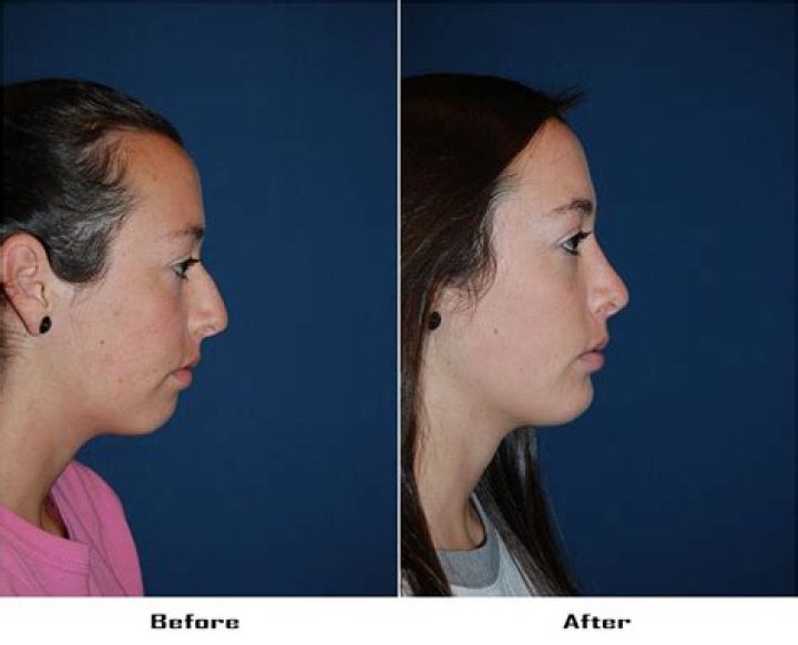 painted by spencer plastic surgery Desirae Mcneill