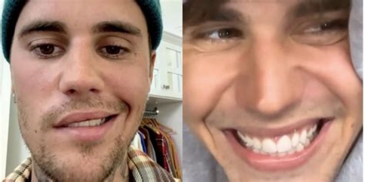 Par&aacute;lisis facial de Justin Bieber 'Derram&eacute; un par de l&aacute;grimas' La