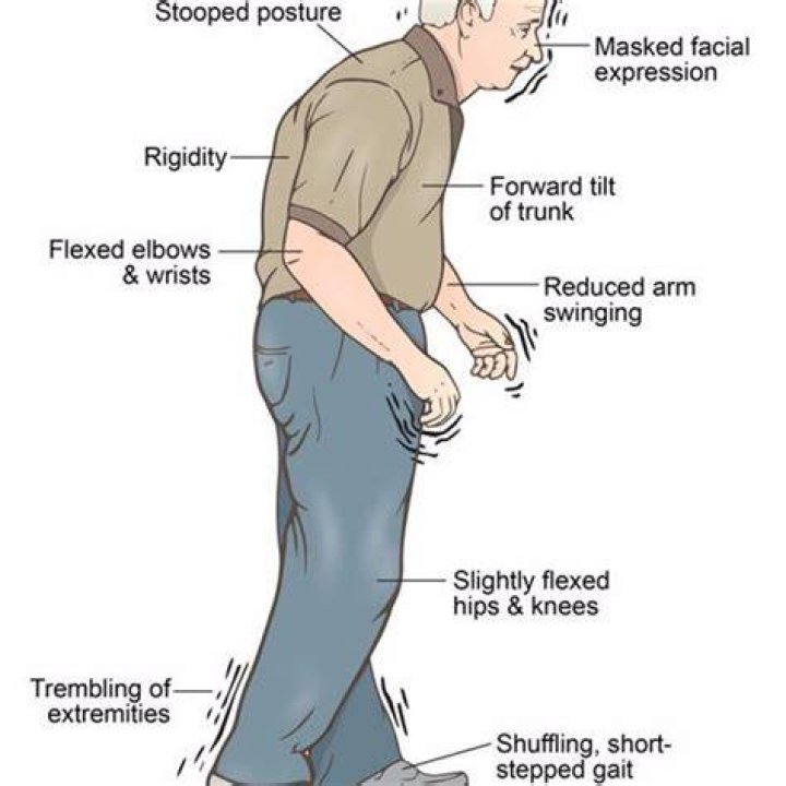 Parkinson's Disease Natural Treatment and Remedies in 5 Steps Dr. Axe