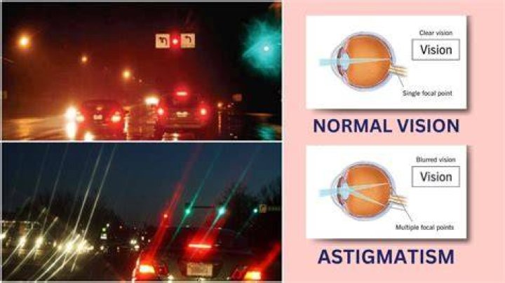 People with astigmatism driving at night ff be like )