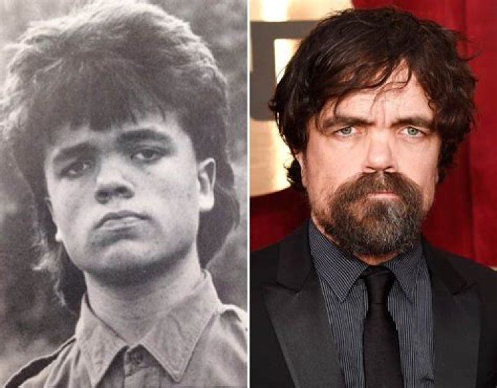 Peter Dinklage Childhood Story Plus Untold Biography Facts