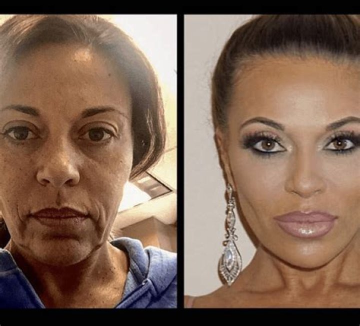 PHOTOS Dolores Catania Shares Before & After Pics of Plastic Surgery!