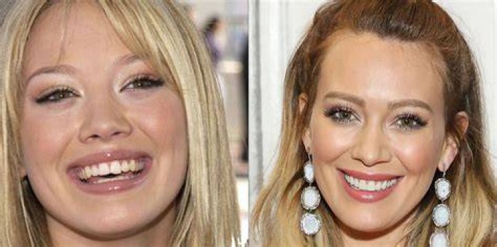 Pin on Celebrities Before and after
