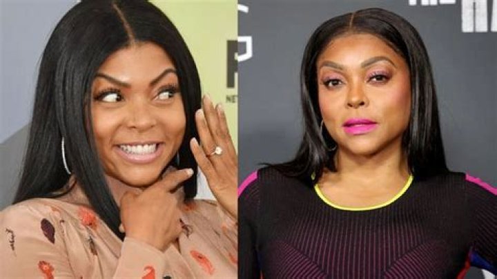 Pin on Celebrity plastic surgery before and after photos