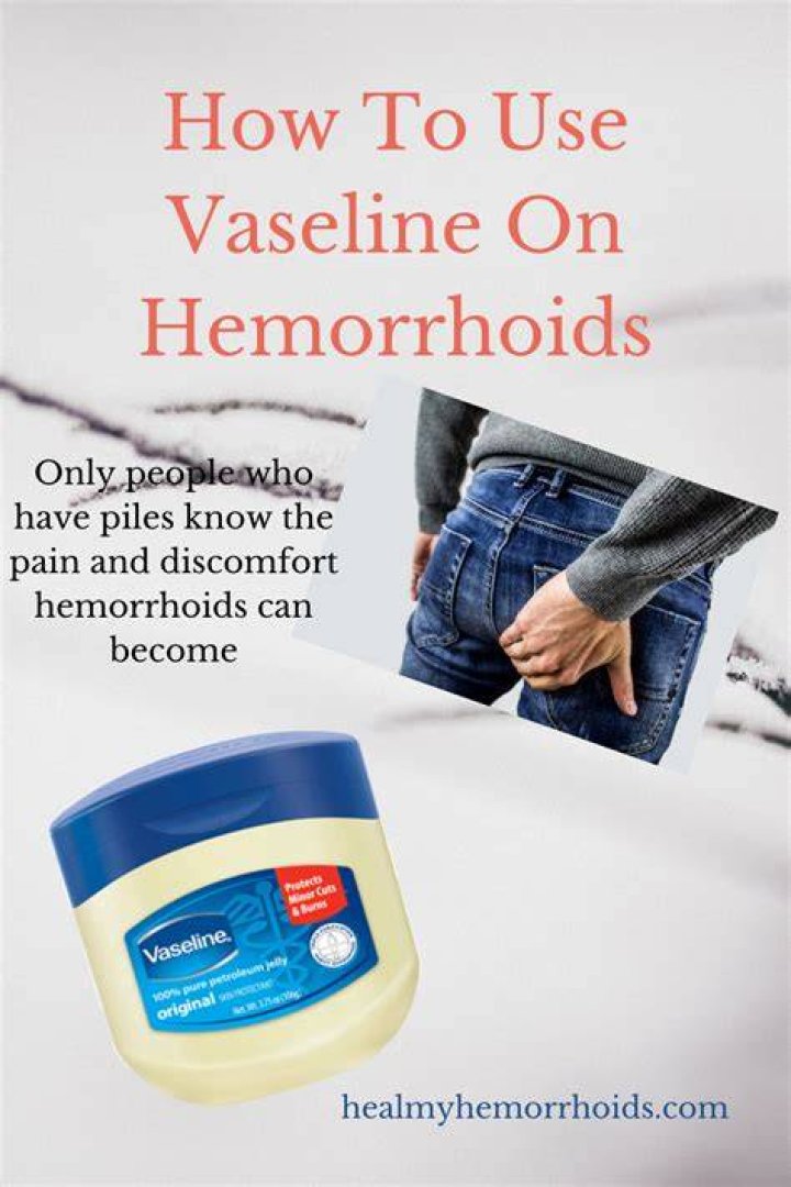 Pin on Hemorrhoid Relief