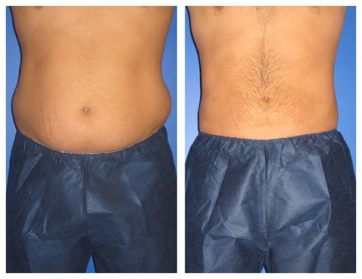 Pin on Plastic Surgery