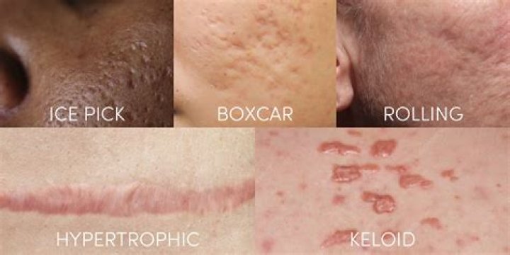 Pin on Scars and other distinguishing marks