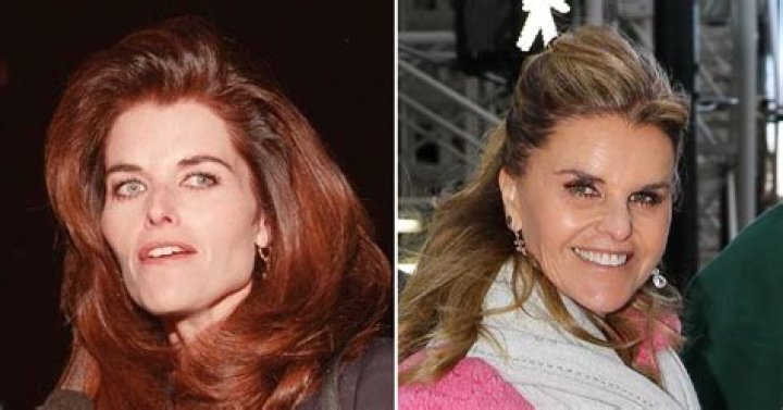 Plastic Surgeons Shocked At Arnold Schwarzenegger&rsquo;s ExWife Maria