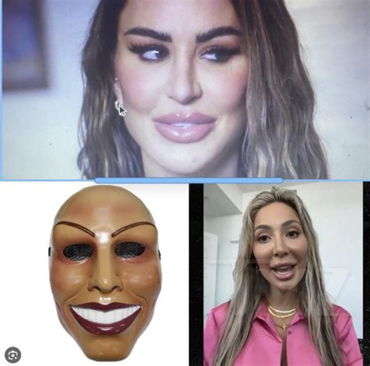 Plastic surgery stars Mirror Online
