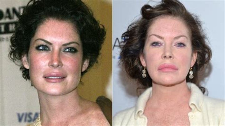 Plastic Surgery? Watch Lara Flynn Boyle's Transformation Right Before